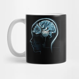 Cat Owner Brain Mug